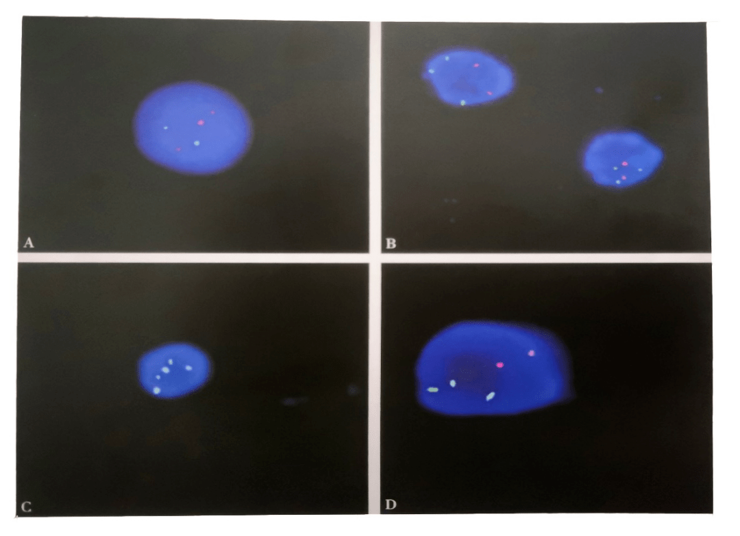 医学前沿丨揭开fish的神秘面纱