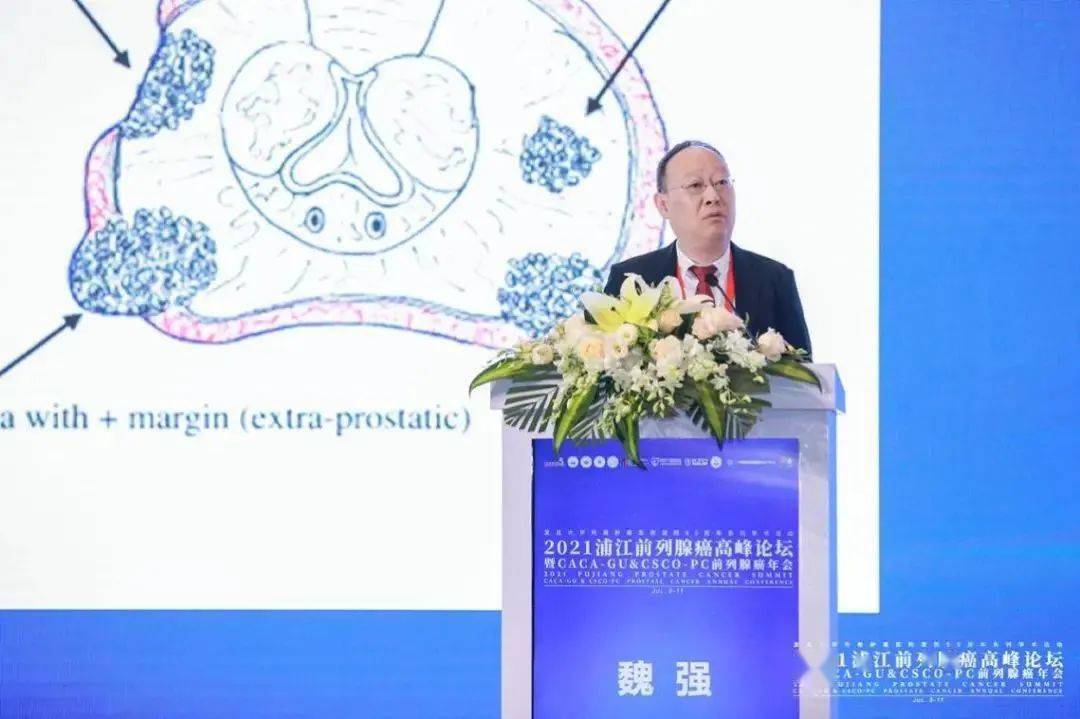 魏强教授局部晚期前列腺癌如何减少切缘阳性丨2021浦江前列腺癌高峰