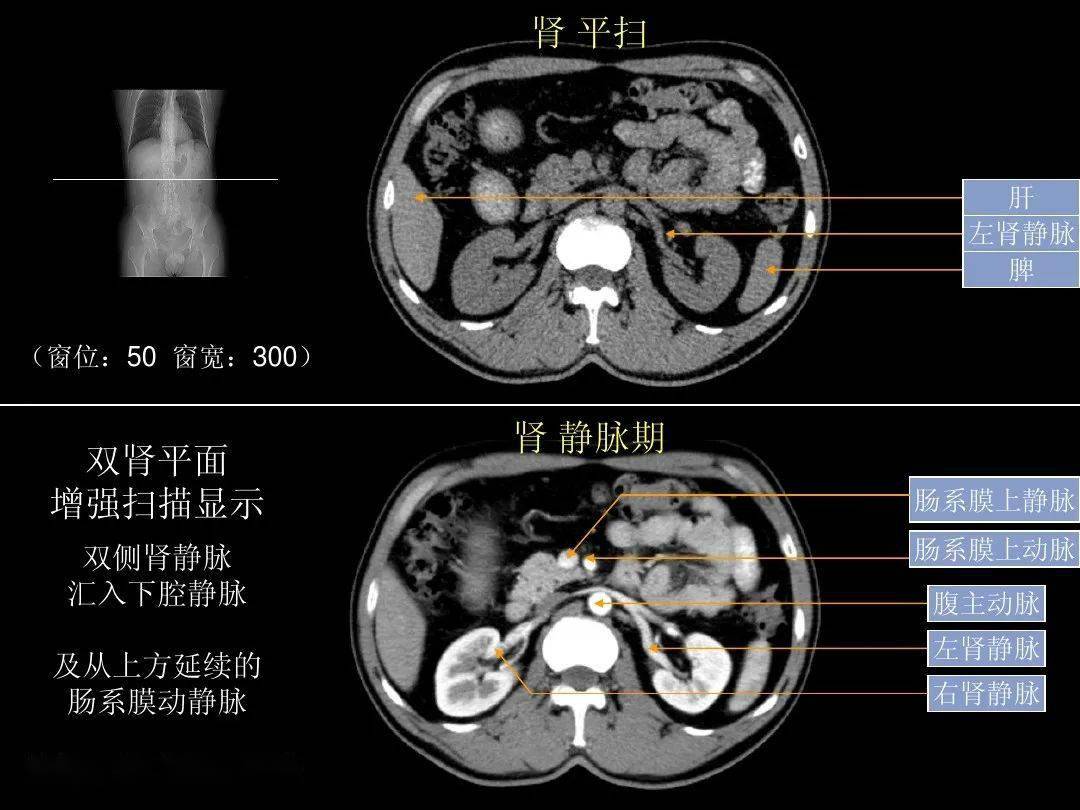超细的腹部ct应用入门必备手册(原理 精美解剖图谱)
