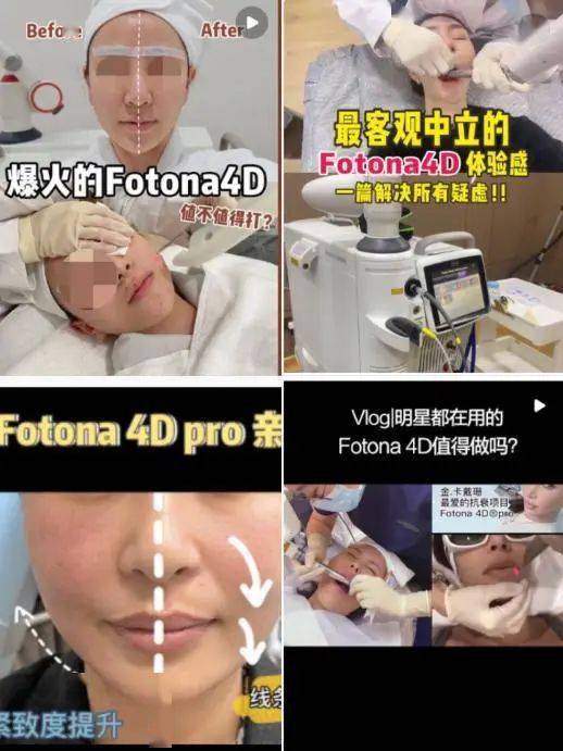 操作|被嘲热搜钉子户，除了家庭背景和前男友，她还有啥？
