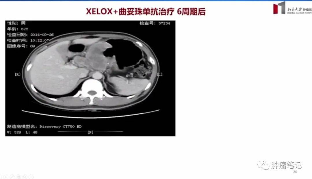 什么叫特殊类型的综合症 94ce2a27fd6444e2bafc8486b9996ecd.jpeg