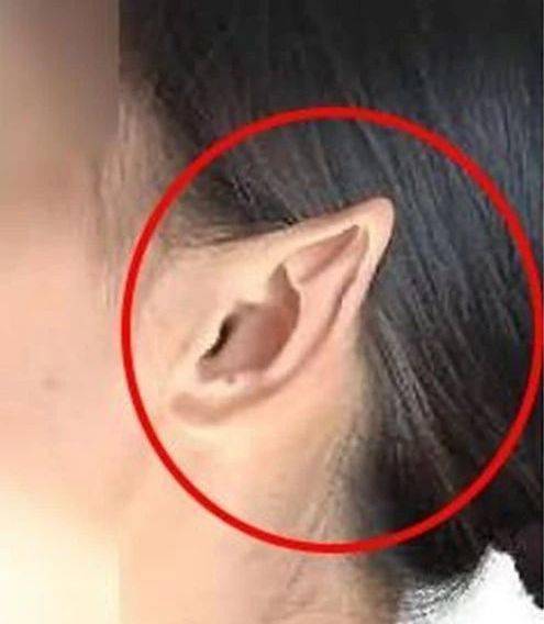 中国富豪有小耳朵吗图片