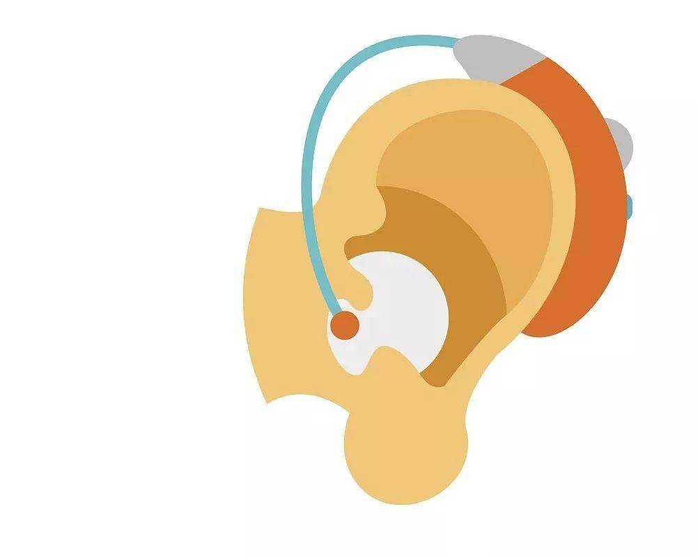 助听器——让更多人听到爱的呼唤