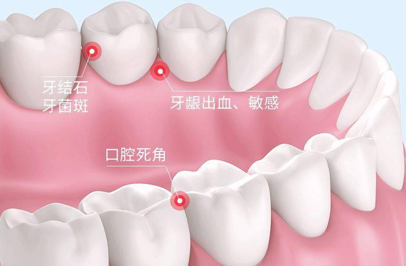 不用刷牙的食物 567801b68448471b93daa9e571de0bdf.jpeg