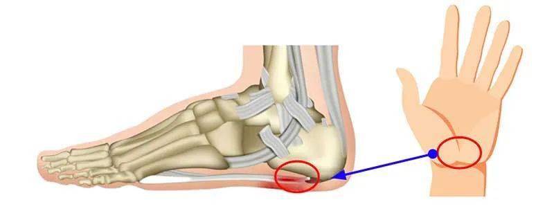 腳跟腳底痛(足底筋膜炎)的4種經絡組合型態,8種方法徹底解決!