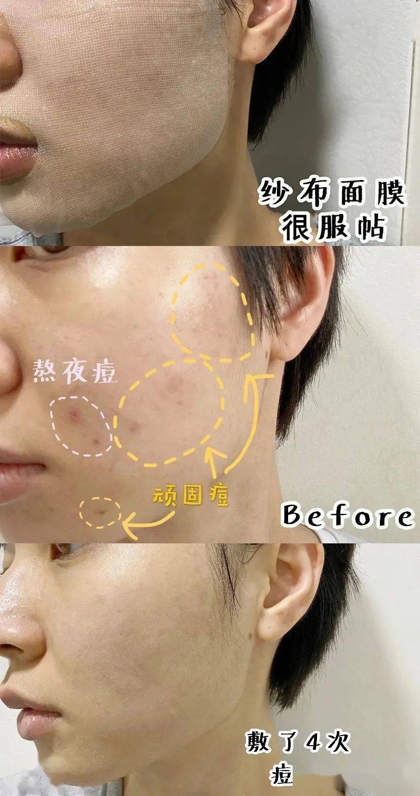 范冰冰|种草100遍的HFP面膜，这次竟然5折！！