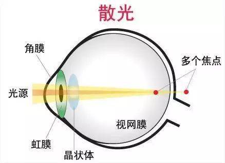 近视人口_重庆近视防治中心介绍中国近视现状