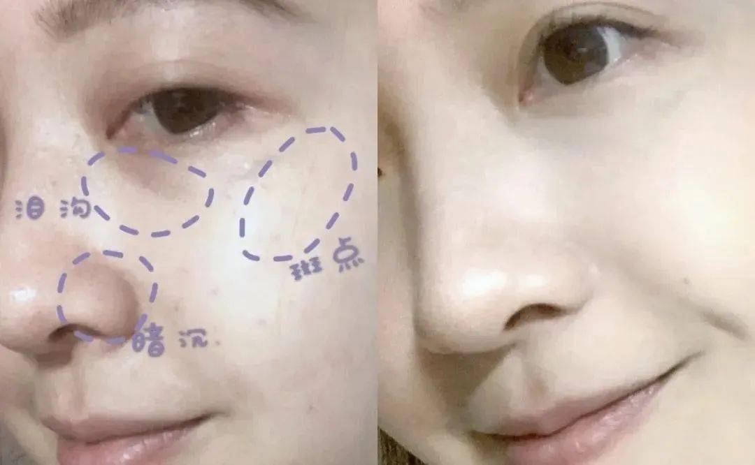 脸怎么变得水润有光泽 9722dbcb6d14417e8ff3e64c5cdace53.jpeg