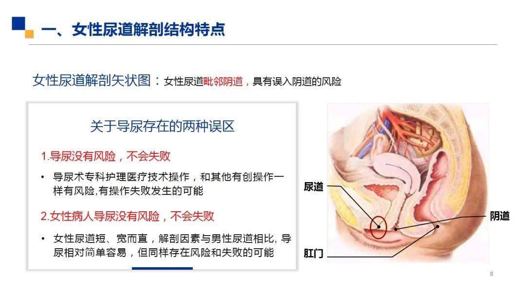 导尿术女性尿道口位置图片