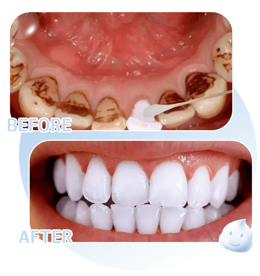也让牙齿变得更加健康