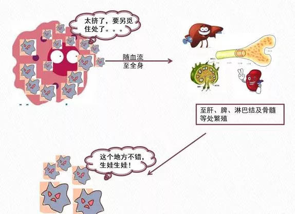 病因|江苏阿婆反复高烧一个月,排除新冠仍不明病因,最后医生发现源头在动物身上