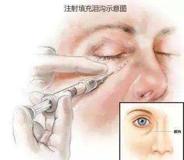 丁玉|被三个男人抛弃，事业巅峰期消失，这个乐坛一姐背后故事竟如此心酸
