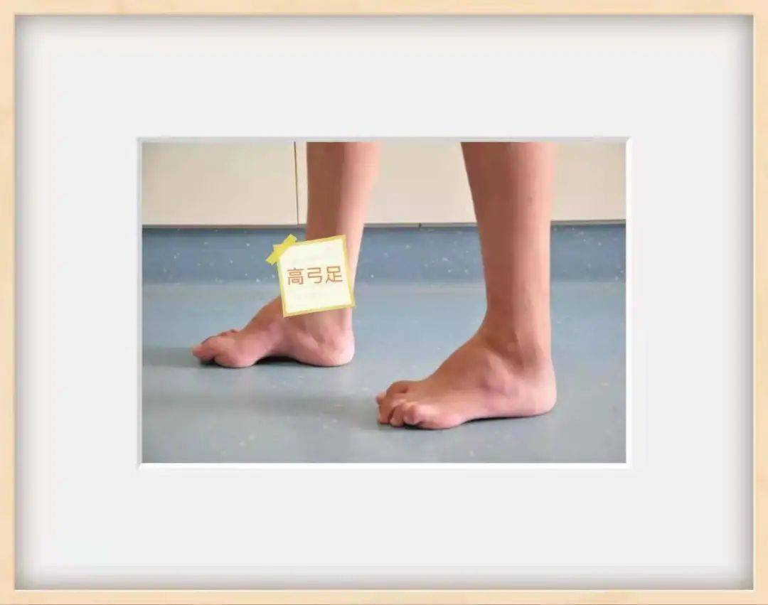 脚痛?你的jio jio可能有问题!