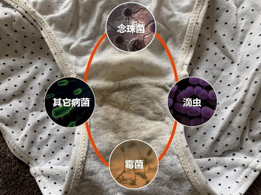 秘密|性开放的日本，为何妇科问题全球最低？秘密竟然是...