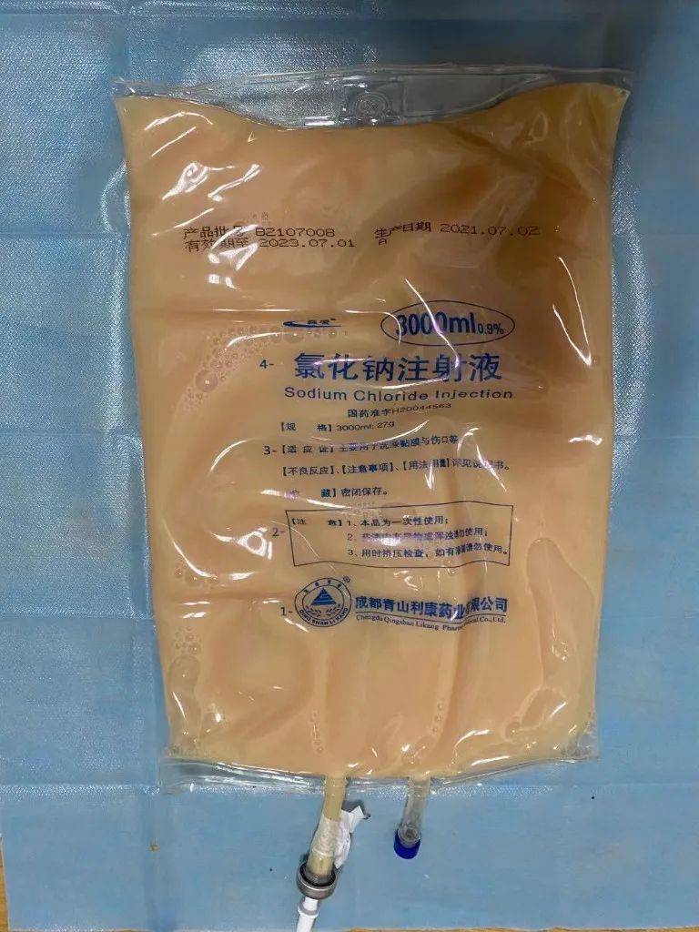 控制|驚！男子體內竟抽出乳白色的“牛奶血”！