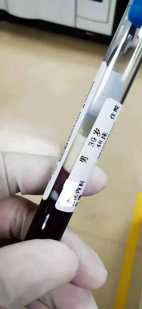 控制|驚！男子體內竟抽出乳白色的“牛奶血”！