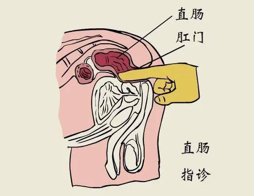 直肠的弯曲图片