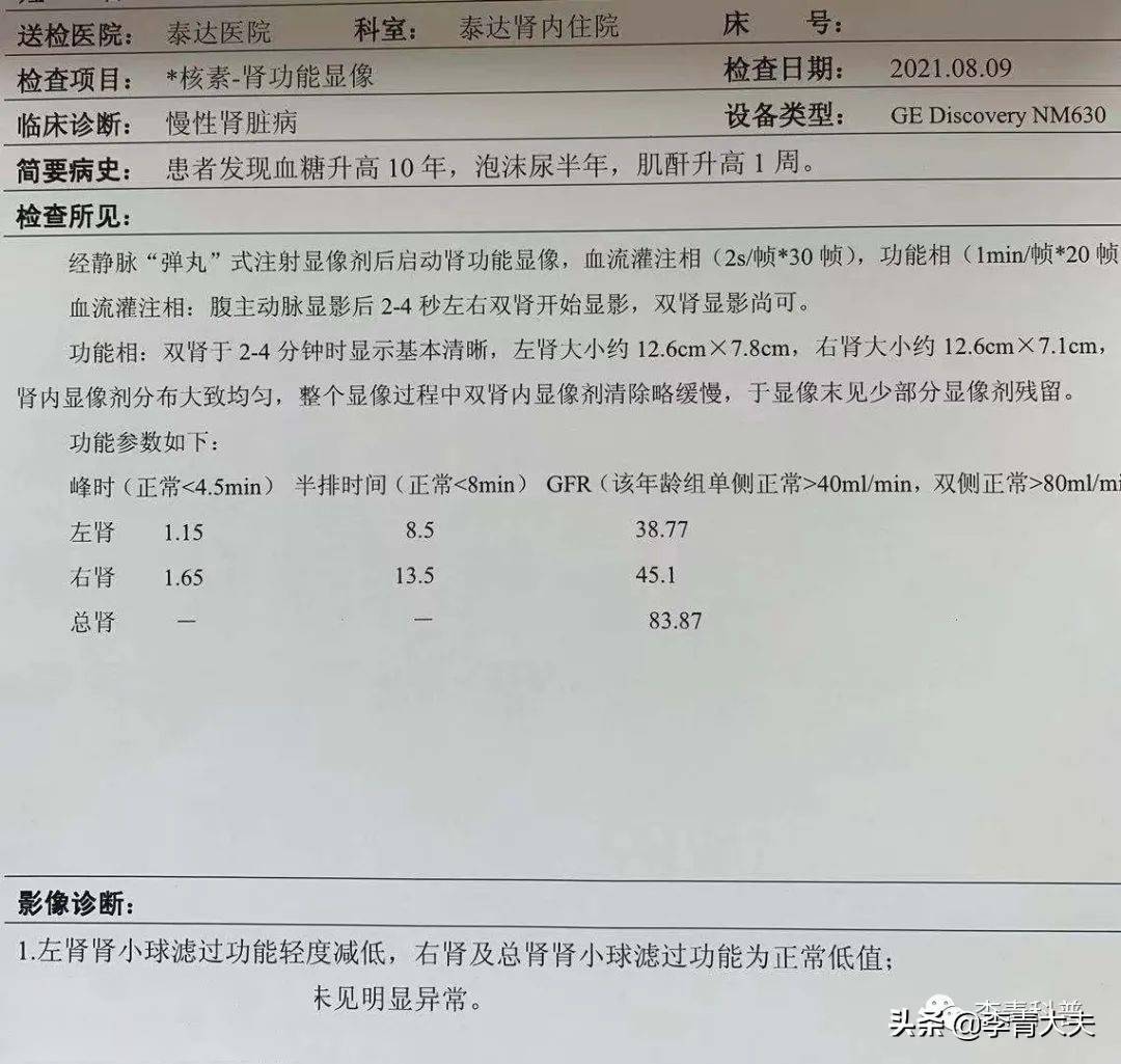 11mmol/l,尿蛋白定量9g/l,已经是肾病综合征,血肌酐升高,肾功能轻度