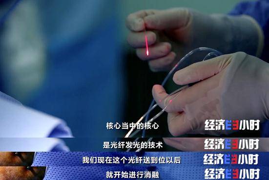 技术|重大利好！不开颅治疗脑肿瘤，费用预计为国外的5%！