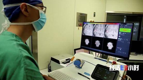 技术|重大利好！不开颅治疗脑肿瘤，费用预计为国外的5%！