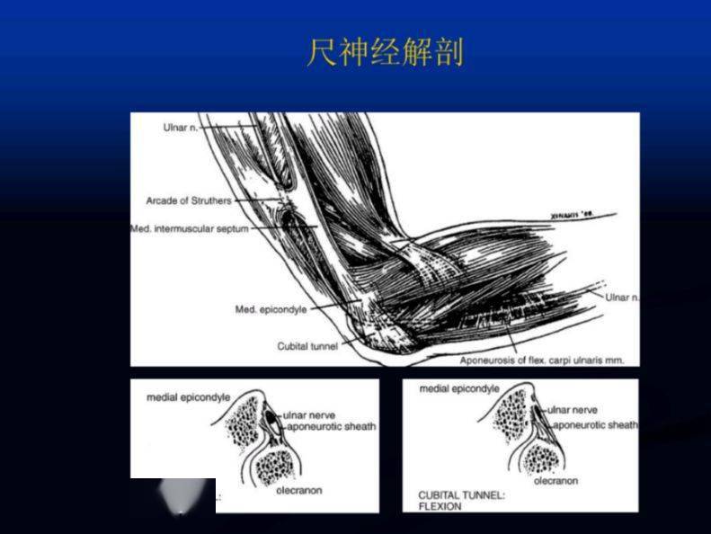 肘關節影像解剖及常見病變mr表現