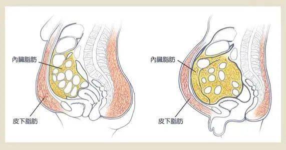 如何判断自己的脂肪是内脏脂肪还是皮下脂肪?