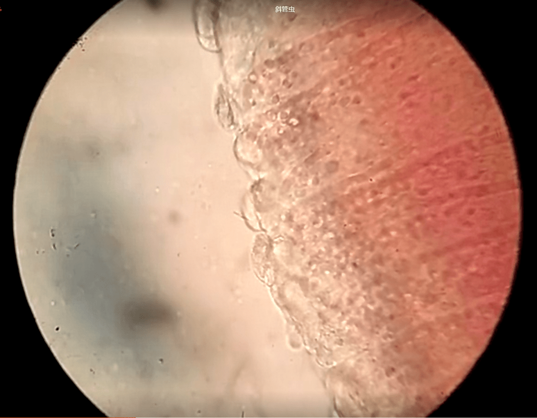 鱼类常见寄生虫之斜管虫_鱼体