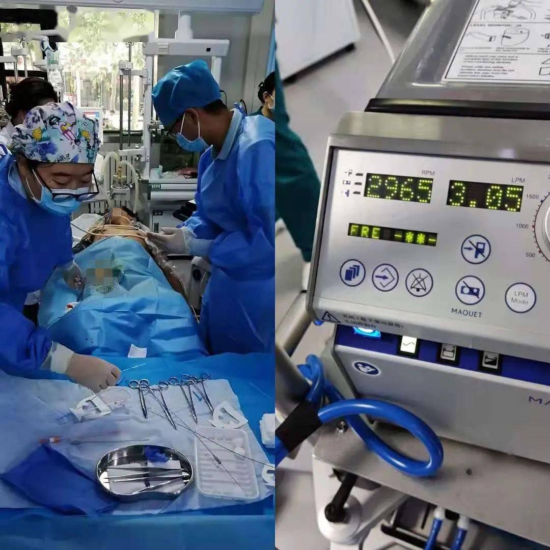 血压持续偏低,紧急启动高级生命支持——体外膜肺氧合(ecmo)