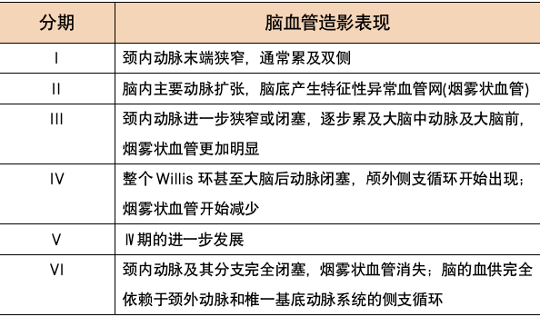 血管|這種病引起的「頭痛」，我真沒想到