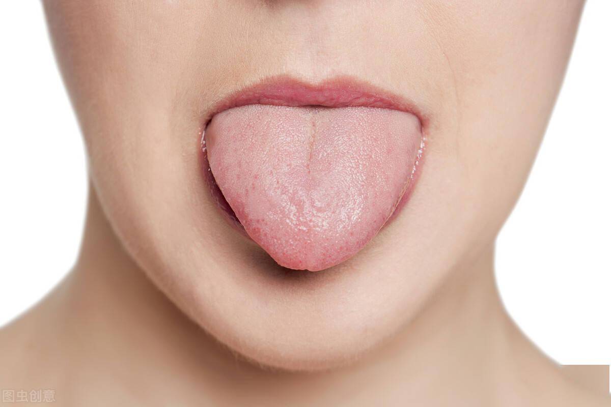 照镜子看看自己的舌头 留意这7个异常变化 可能暗藏着疾病 舌苔