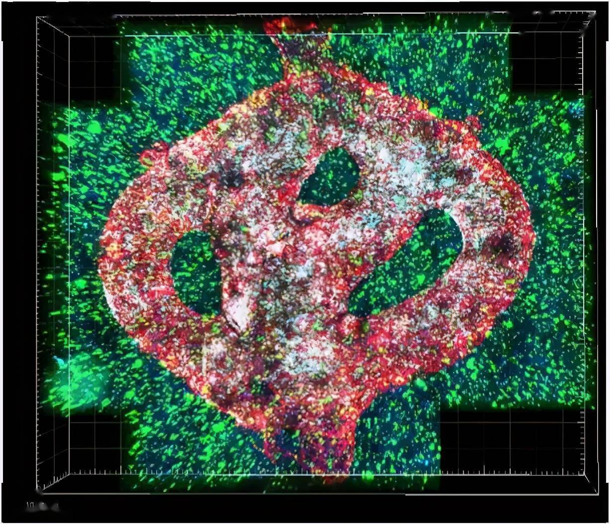 脑科学日报首次3d打印出完整活体胶质母细胞瘤