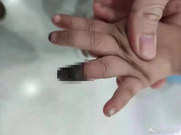 鸽子|吞蝌蚪喝蟑螂水吃鸽子粪，你被“偏方秘方”坑过吗？