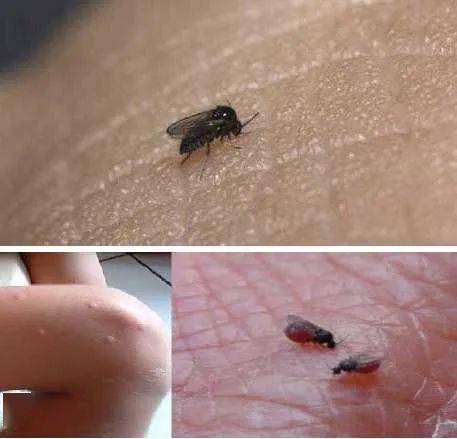 这种叫蠓的小飞虫能把你咬到懵圈防治锦囊收好不谢