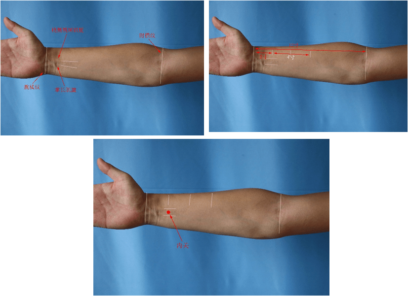 7.行间 在足背,当第1,2趾间,趾蹼缘后方赤白肉际处.