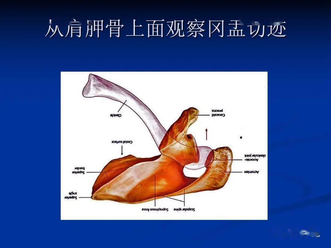 四个滑囊:肩峰下滑囊,三角肌下滑囊,喙突下滑囊,肩胛下滑囊.