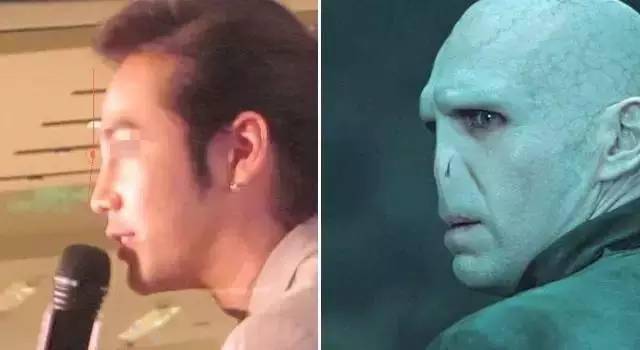 就因为没有好看鼻子,人都跟着丑了5分!
