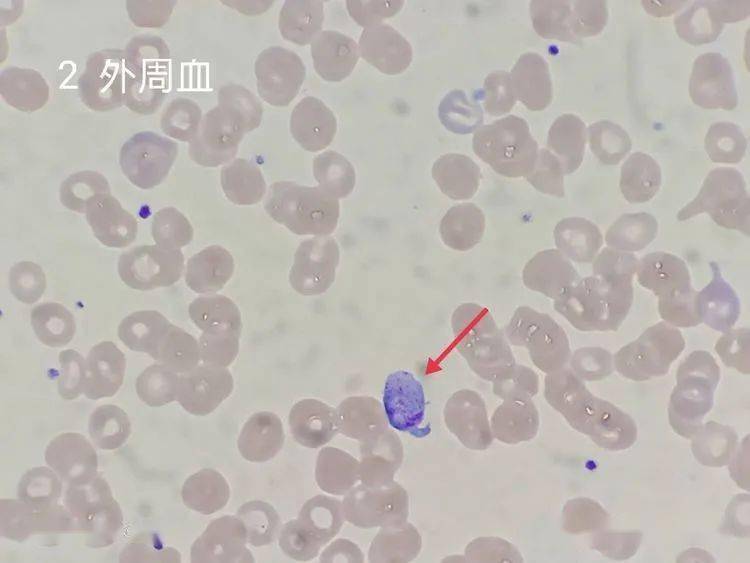 看图识细胞(第104期)