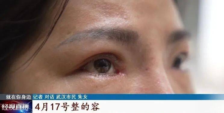 症状|说好的整成舒淇同款鼻,结果连微笑都成问题!更麻烦的是……