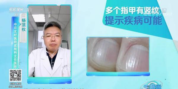 变化|请低头：长这几种指甲的人注意了