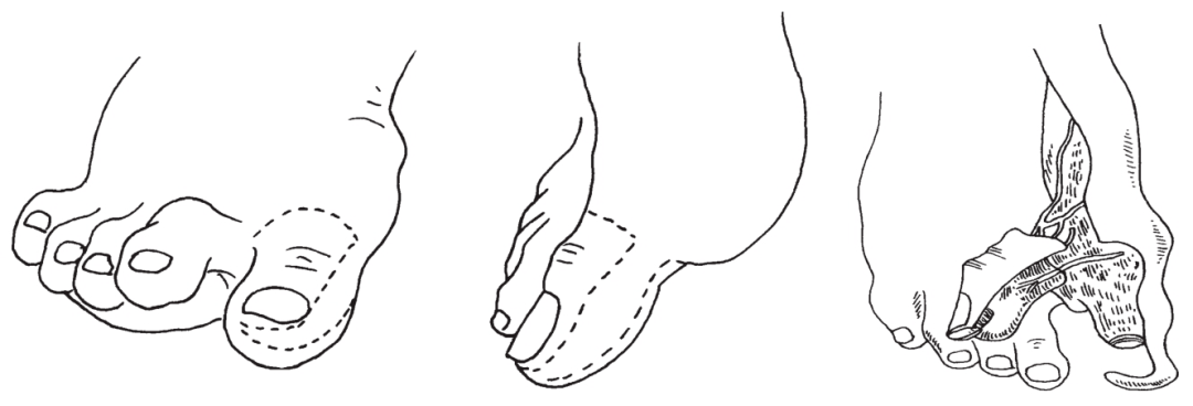 超级实用,但你永远不想用到的知识_断肢