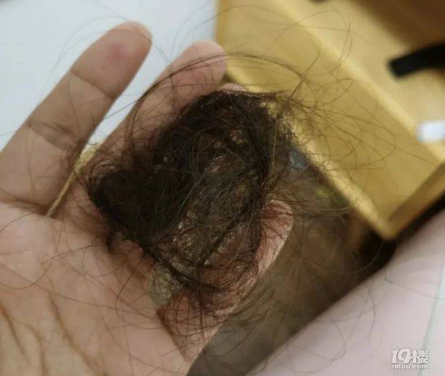 头皮|姑娘崩溃发帖，“我还没生孩子就这样了”