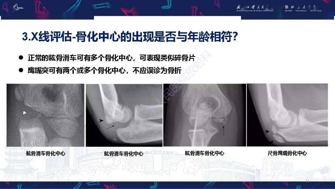 兒童肘關節外傷x線診斷_解剖圖