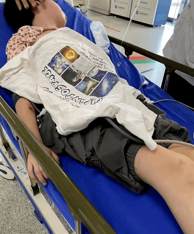 机器把手突然脱落刺入女孩腹部情况危急急救护士一路托举抢救女孩