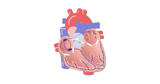 在心房和心室之间产生传导异常,使心脏不能正常收缩和泵血,称为房室