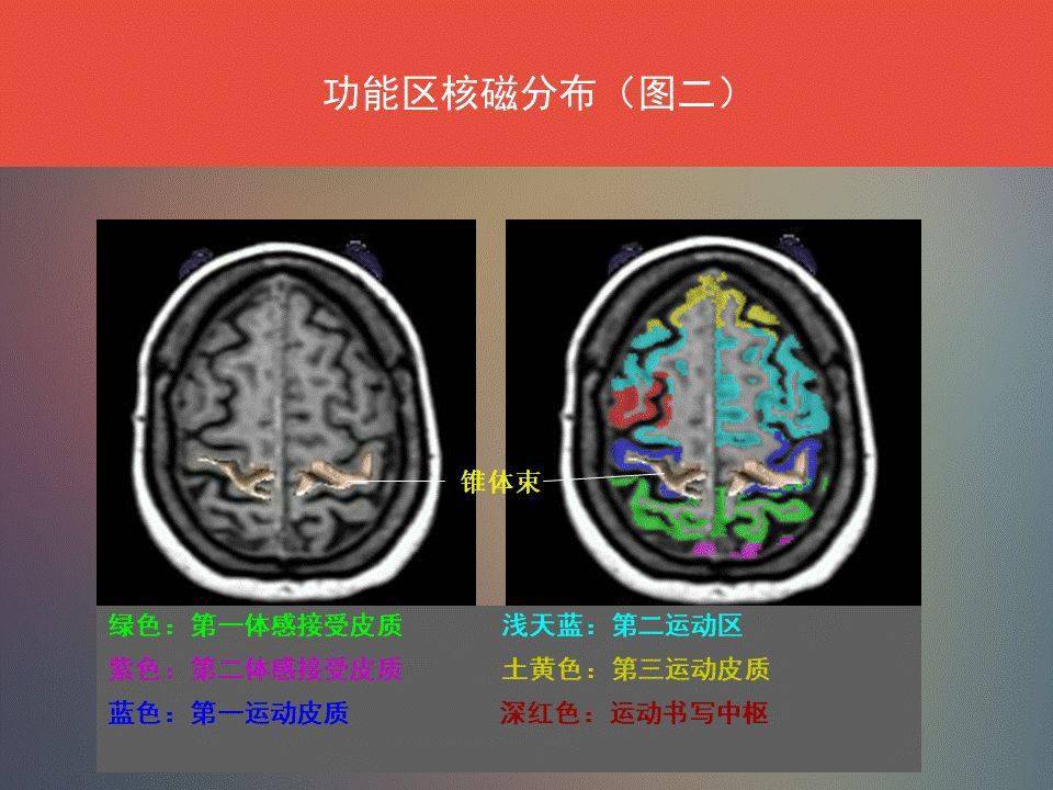 收藏| 腦功能區及解剖學定位(詳細標註)