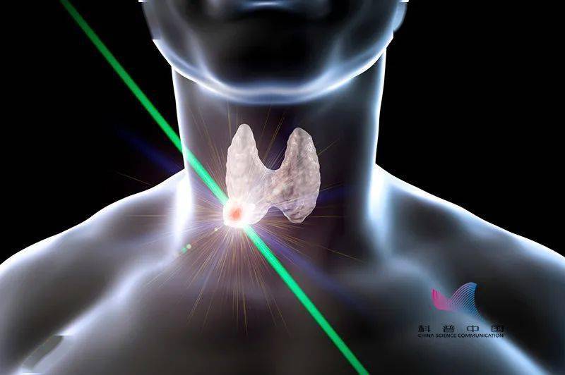 有关|甲亢、甲减患者如何食用盐？竹盐、海盐、强化盐有啥区别？看完就懂了！