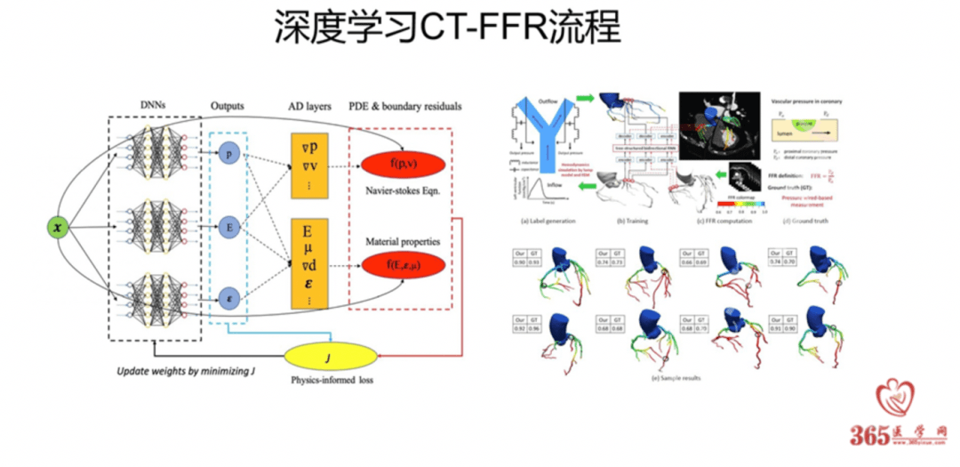 医学影像科[6)目前,有全球有多家公司正基于机器深度学习的计算方法