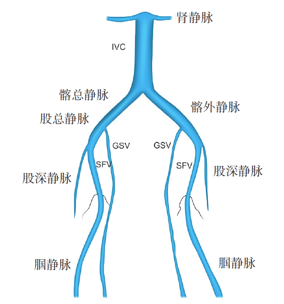 869 手术解剖(a)左股总静脉注射造影剂,发现髂外静脉和髂总静脉内