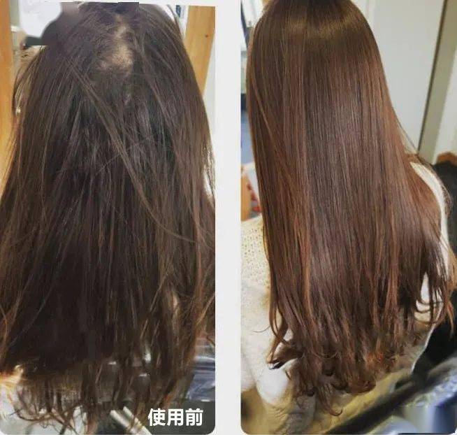 汪女士|白发越长越多？原来是这里出了毛病！坚持一招，养一头乌黑墨发！