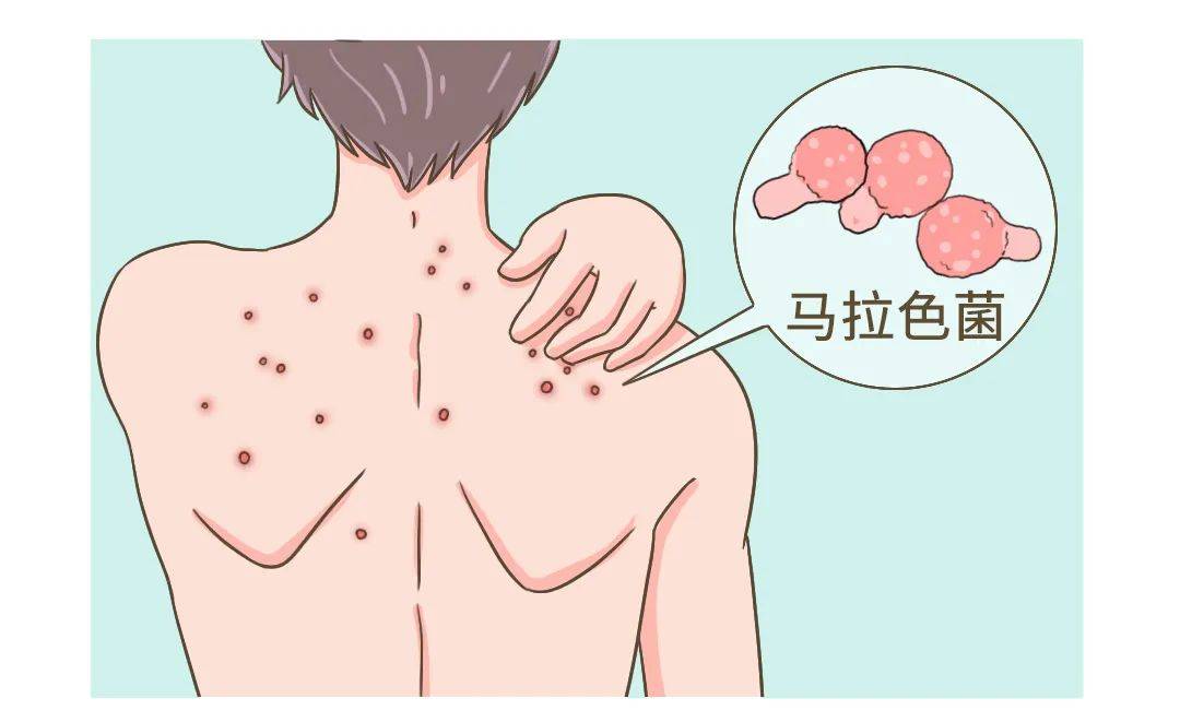 汗液|洗澡要不要搓泥？应该多久洗一次澡？